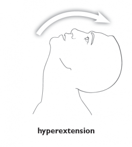 Hyperextension